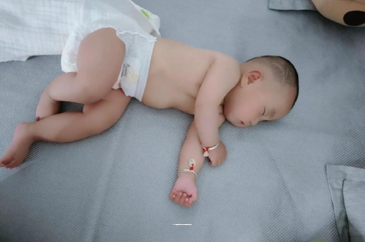 岳阳六个月宝宝眼睛散光